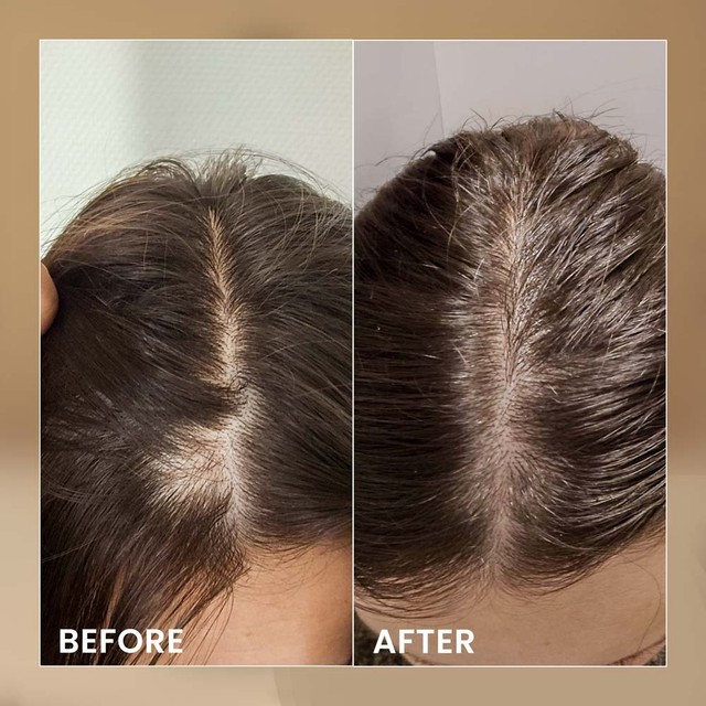 BIOELIXIR-SCALP----prije-posle---ENG