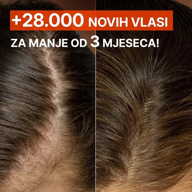 SLAJD-7----PRIJE-POSLIJE